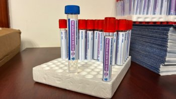 Distribuye SDR 8 mil kits preventivos contra el Gusano Barrenador del Ganado en todo el estado