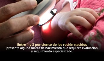 Marcas de nacimiento en bebés: cuándo requieren valoración dermatológica