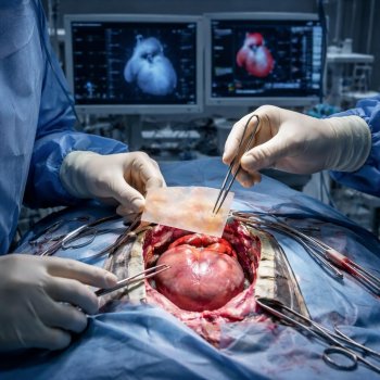 Hospital de Japón realiza la primera cirugía de corazón con células madre
