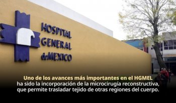 Hospital General de México programa 135 reconstrucciones mamarias para octubre de 2026