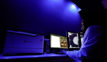 ISSSTE reporta cero mastografías pendientes tras abrir Cuartos Azules con inteligencia artificial