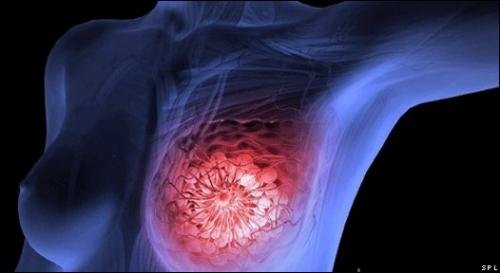 BUSCA XOCHIMILCO PREVENIR CÁNCER