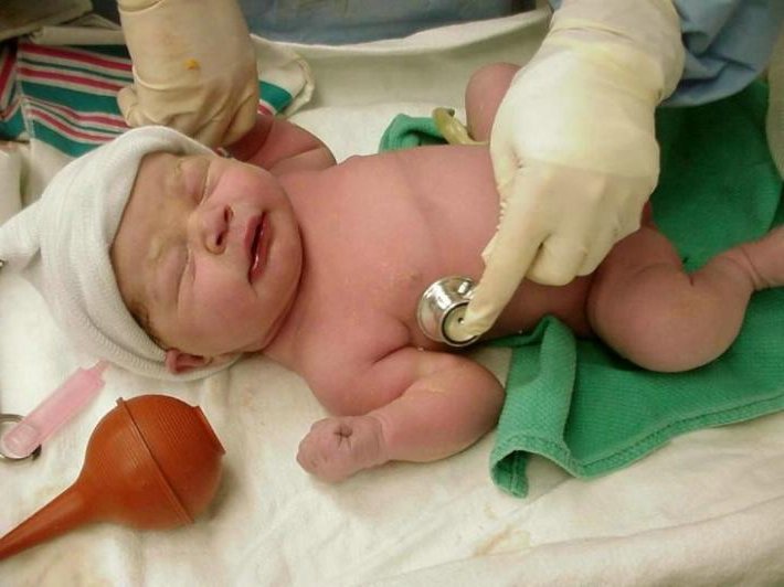 PLANTEAN CREAR UN REGISTRO ELECTRÓNICO DACTILAR NEONATAL