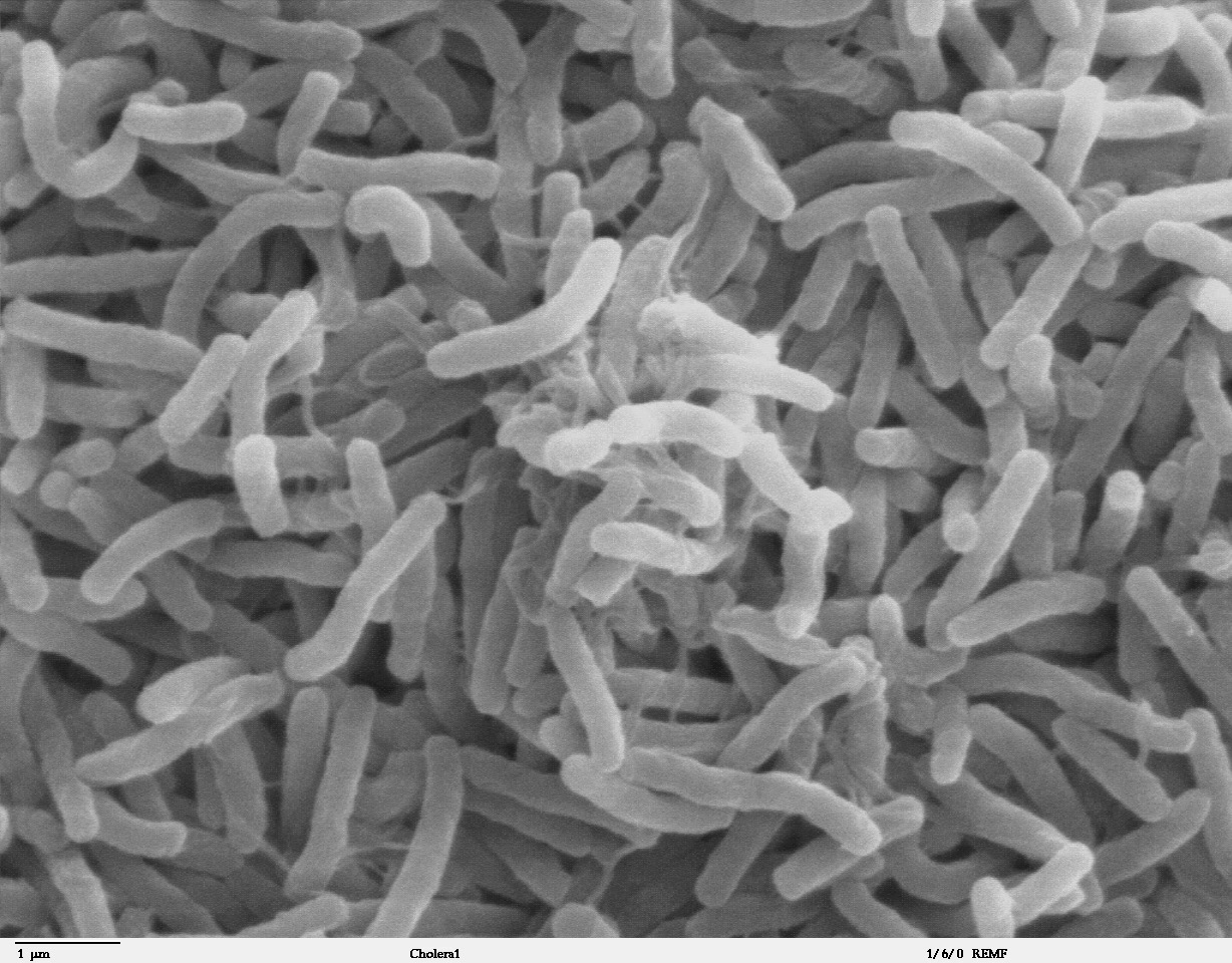 Avanzan investigación sobre origen del cólera