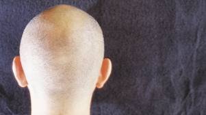 HOSPITAL JUÃREZ DE MÉXICO CONMEMORA 10º ANIVERSARIO DE SU SERVICIO DE ONCOPEDIATRIA