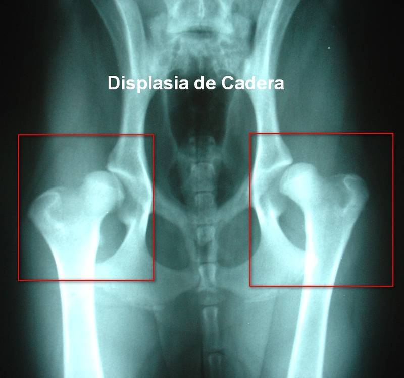 Avalan reforma para detección oportuna de displasia de cadera