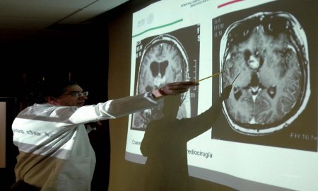 EXITOSA INTERVENCIÃ“N NO INVASIVA PARA ATENDER LESIONES CEREBRALES