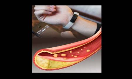 Crean en la UNAM pulsera para medir colesterol y triglicÃ©ridos en tiempo real