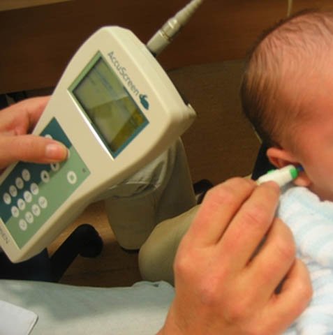 Detección oportuna de sordera con tamiz auditivo neonatal